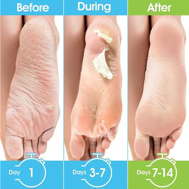 1 Pag=1 Pair Honey Foot Mask F - Foot Mask Peeling recensie en prijs