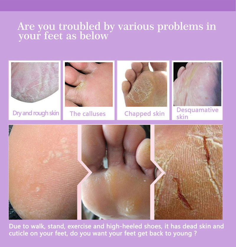 Feet Exfoliating Foot Masks Pe - Foot Mask Peeling recensie en prijs