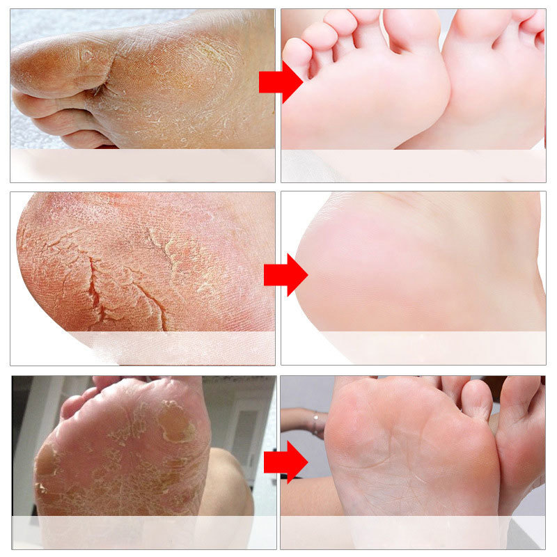 Feet Exfoliating Foot Masks Pe - Foot Mask Peeling recensie en prijs