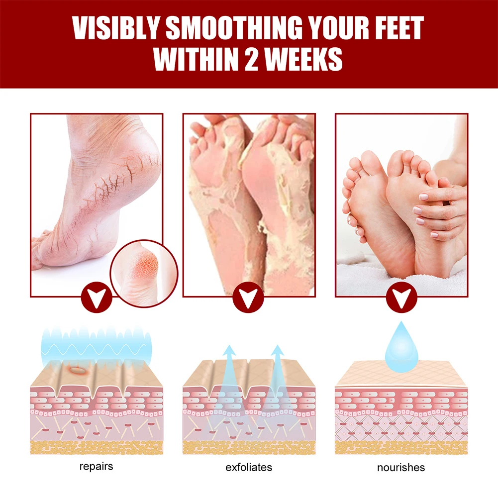 5/2/1 Pairs Foot Mask Fruit Ac - Foot Mask Peeling recensie en prijs