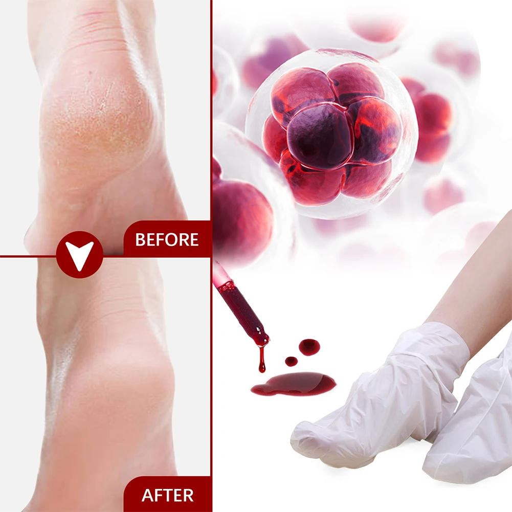 5/2/1 Pairs Foot Mask Fruit Ac - Foot Mask Peeling recensie en prijs